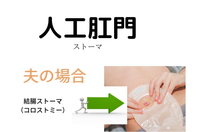 肛門がん手術の準備方法